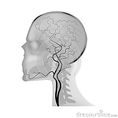 MR angiography of cerebral vessels. Vector Illustration